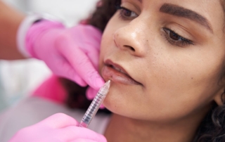Osoba poddająca się zabiegowi powiększania ust kwasem hialuronowym.