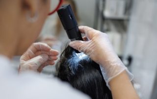 Trycholog przeprowadza badanie skóry głowy za pomocą specjalnego urządzenia.