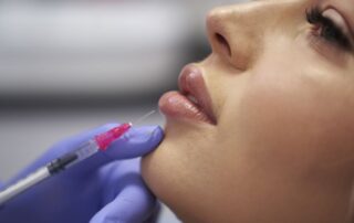 Powiększanie ust kwasem hialuronowym u alergików bywa bezpieczne przy kwalifikacji lekarskiej i stabilnej alergii; alergia na HA jest rzadka.