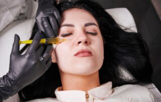 Wampirzy lifting na cienie pod oczami pomaga przy cienkiej skórze i słabym mikrokrążeniu; efekt po 2–4 tyg. Autologiczny koncentrat z krwi.