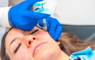 Wampirzy lifting PRP poprawia nawilżenie, elastyczność i koloryt skóry; efekty zwykle po 2–4 tyg., po zabiegu możliwe zaczerwienienie i siniaki.